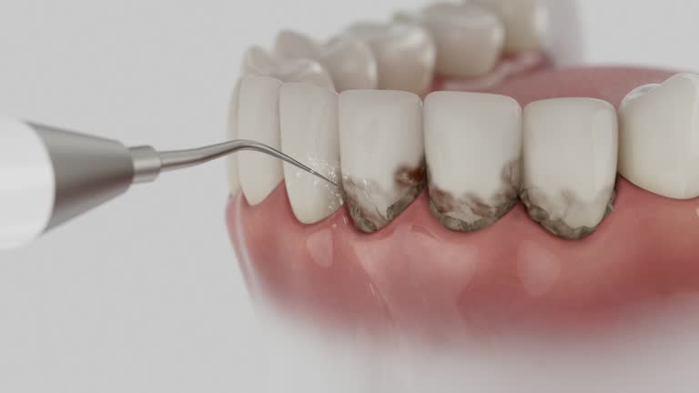 Reliable Dental Implants contractor in Grabill, IN by Smile Center Dentistry